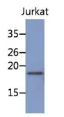Anti-NBL1 antibody [AT38G8] used in Western Blot (WB). GTX53750