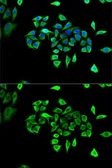 Anti-CLCN5 antibody used in Immunocytochemistry/ Immunofluorescence (ICC/IF). GTX53963