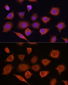 Anti-DDX58 antibody used in Immunocytochemistry/ Immunofluorescence (ICC/IF). GTX54000