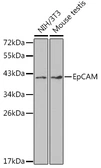 Anti-EpCAM antibody used in Western Blot (WB). GTX54034