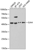 Anti-GJA4 antibody used in Western Blot (WB). GTX54119