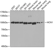 Anti-HCN1 antibody used in Western Blot (WB). GTX54130