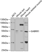 Anti-GABRR1 antibody used in Western Blot (WB). GTX54153