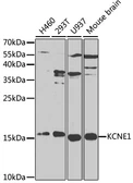 Anti-KCNE1 antibody used in Western Blot (WB). GTX54296