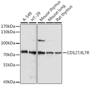 Anti-IL7 Receptor alpha antibody used in Western Blot (WB). GTX54311