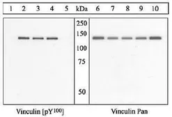 Anti-Vinculin (phospho Tyr100) antibody used in Western Blot (WB). GTX54517