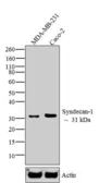 Anti-Syndecan-1 / CD138 antibody used in Western Blot (WB). GTX54537