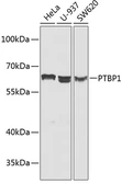Anti-PTBP1 antibody used in Western Blot (WB). GTX54619