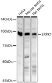 Anti-SRPK1 antibody used in Western Blot (WB). GTX54680