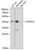 Anti-ST3GAL4 antibody used in Western Blot (WB). GTX54730