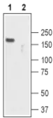 Anti-TRPC2 antibody used in Western Blot (WB). GTX54761