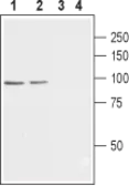 Anti-Cav beta 2 antibody used in Western Blot (WB). GTX54771