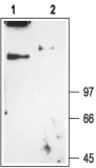 Anti-CLCN1 antibody used in Western Blot (WB). GTX54773