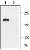 Anti-CFTR antibody used in Western Blot (WB). GTX54774