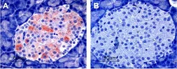 Anti-Kir6.2 antibody used in IHC (Paraffin sections) (IHC-P). GTX54777