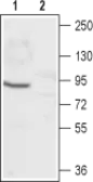 Anti-CNGA1 antibody used in Western Blot (WB). GTX54787