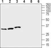 Anti-KCNE1 antibody used in Western Blot (WB). GTX54811