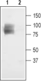 Anti-CLCN3 antibody used in Western Blot (WB). GTX54815