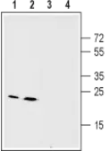 Anti-Connexin 26 antibody used in Western Blot (WB). GTX54817
