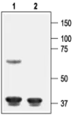 Anti-Kir6.1 antibody used in Western Blot (WB). GTX54833