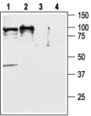 Anti-Orexin Receptor 2 antibody used in Western Blot (WB). GTX54848