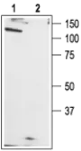 Anti-TRPC1 antibody used in Western Blot (WB). GTX54859