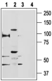 Anti-TRPV5 antibody used in Western Blot (WB). GTX54868