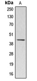 Anti-ACTBL2 antibody used in Western Blot (WB). GTX54883