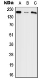 Anti-Agrin antibody used in Western Blot (WB). GTX54904