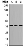 Anti-ABHD4 antibody used in Western Blot (WB). GTX54932