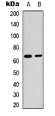 Anti-NFkB p65 (Acetyl Lys221) antibody used in Western Blot (WB). GTX54951