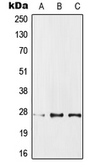 Anti-IPP1 antibody used in Western Blot (WB). GTX55217
