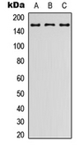 Anti-Latrophilin 2 antibody used in Western Blot (WB). GTX55247