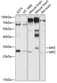 Anti-MPZ antibody used in Western Blot (WB). GTX55712