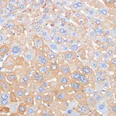 Anti-Serum Amyloid P antibody used in IHC (Paraffin sections) (IHC-P). GTX55792