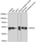 Anti-SMYD1 antibody used in Western Blot (WB). GTX55803