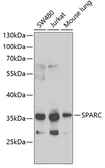 Anti-SPARC antibody used in Western Blot (WB). GTX55805