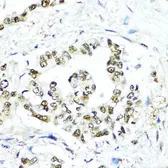 Anti-SUMO1 antibody used in IHC (Paraffin sections) (IHC-P). GTX55812