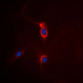 Anti-mGluR4 antibody used in Immunocytochemistry/ Immunofluorescence (ICC/IF). GTX55859