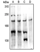 Anti-PTP kappa antibody used in Western Blot (WB). GTX55884