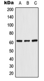 Anti-UGT8 antibody used in Western Blot (WB). GTX55898