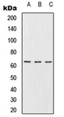 Anti-RMP antibody used in Western Blot (WB). GTX55904