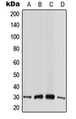 Anti-CABP4 antibody used in Western Blot (WB). GTX55968