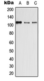 Anti-Desmoglein 4 antibody used in Western Blot (WB). GTX55984