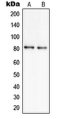 Anti-SLC6A17 antibody used in Western Blot (WB). GTX55991