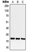 Anti-CREG1 antibody used in Western Blot (WB). GTX56002