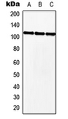 Anti-MKL2 antibody used in Western Blot (WB). GTX56012