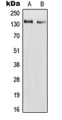 Anti-RAPH1 antibody used in Western Blot (WB). GTX56014