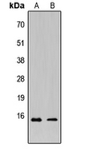 Anti-KCNE1L antibody used in Western Blot (WB). GTX56058