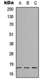 Anti-SYT8 antibody used in Western Blot (WB). GTX56122